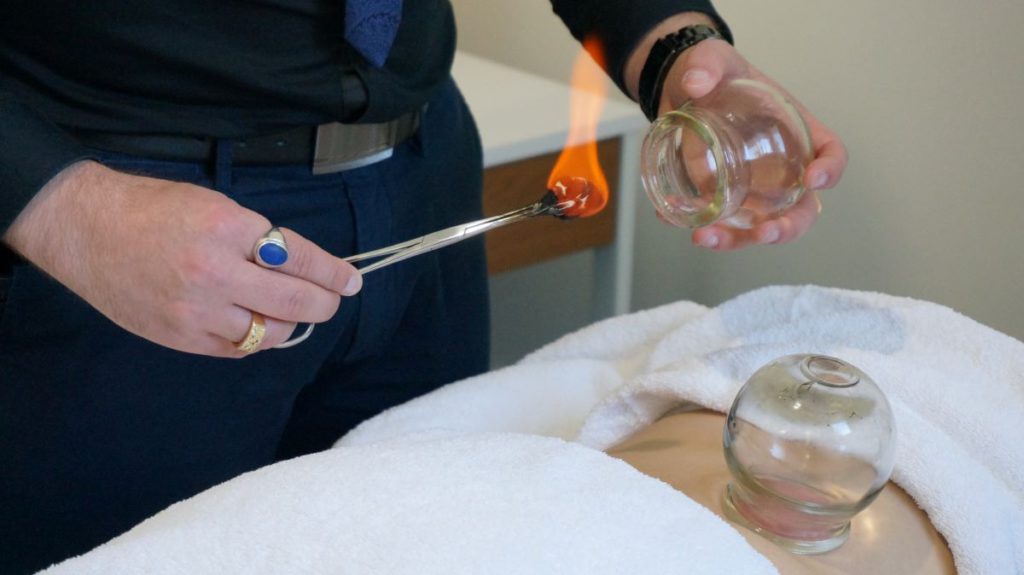 Cupping Therapy Benefits: Heal and Revitalize in Melbourne