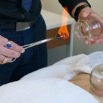 Cupping Therapy Benefits: Heal and Revitalize in Melbourne