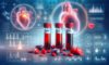 Cholesterol Blood Test: Key Health Insights for Milton Keynes